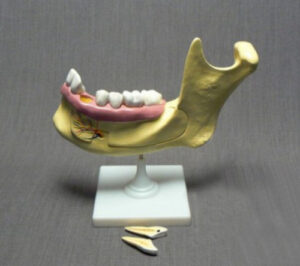 Модель разборная Челюсть человека